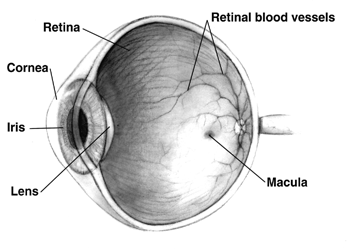Facts about Macular Hole and vitrectomy treatment